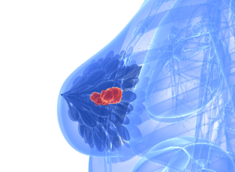Hoja de datos: La evolución en el tratamiento del cáncer de mama HER2 positivo
