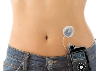 Microinfusor de insulina: una alternativa de tratamiento que mejora la calidad de vida de personas con diabetes