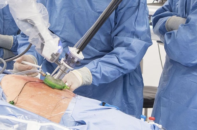 Cleveland Clinic es el primer hospital en EE.UU. en realizar una cirugía de próstata con un Robot Single Port SP