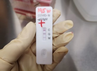 Estudio internacional realizado en Panamá muestra desempeño de prueba serológica para el COVID-19 y seroprevalencia en trabajadores de salud y donantes de sangre