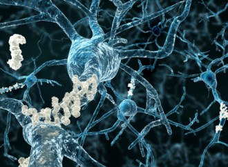 Cleveland Clinic lanza primer estudio cerebral dirigido a diagnosticar y prevenir enfermedades neurológicas antes de que se presenten los síntomas